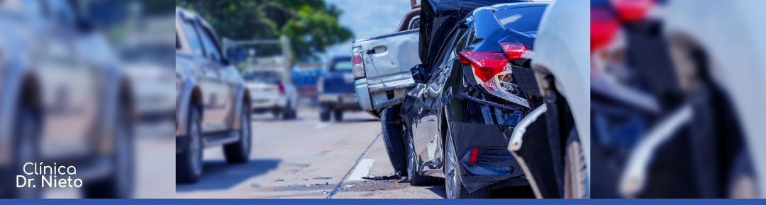 clinica-dr-nieto-antonio-hernandez-conesa-accidente-de-trafico-medico-abogado-perito-medico-especialista